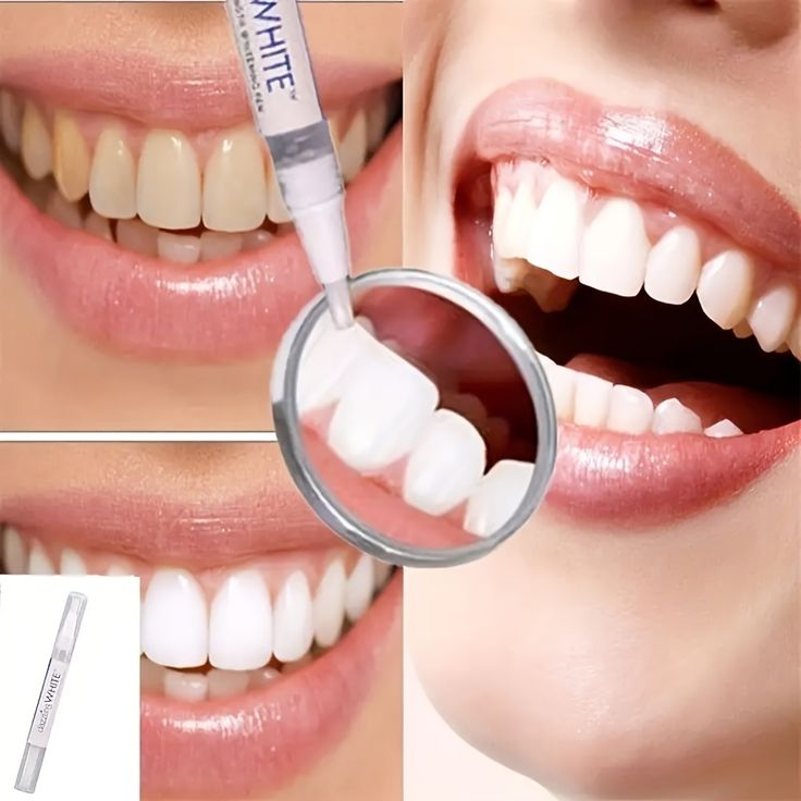 Serum de blanchiment des dents BF