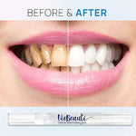 Charger l&#39;image dans la galerie, Serum de blanchiment des dents BF
