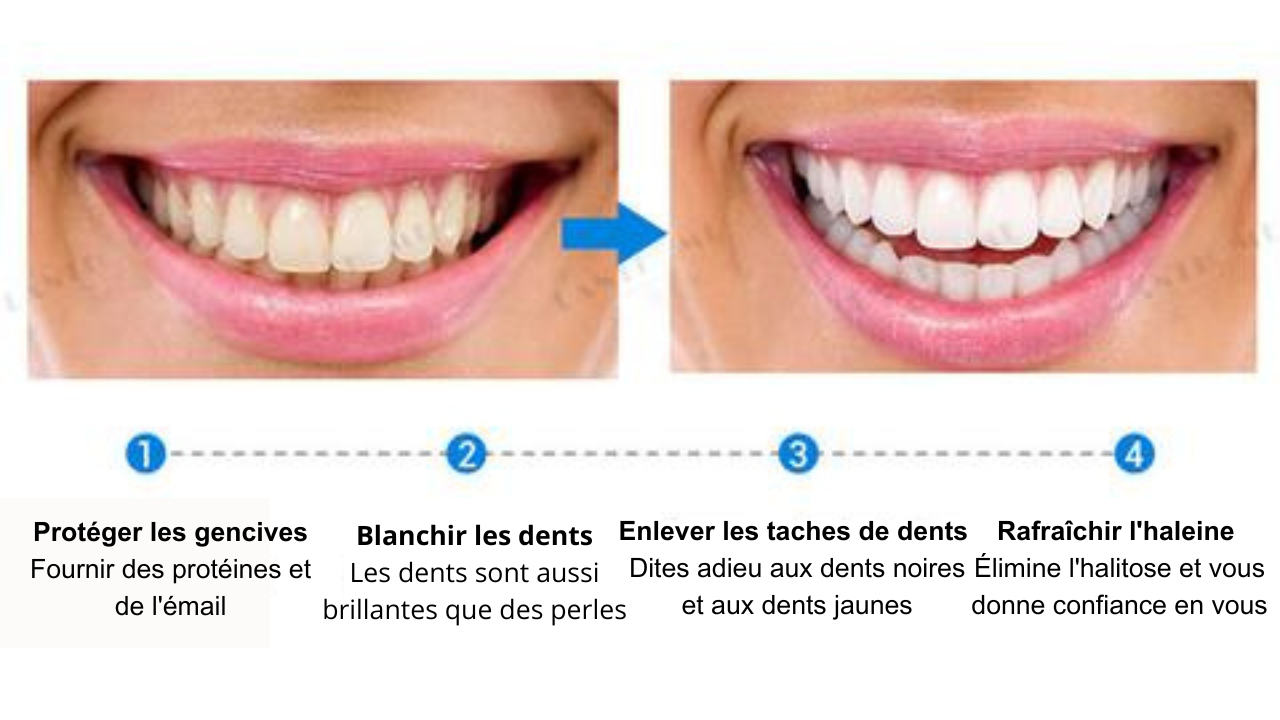 Serum de blanchiment des dents BF