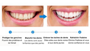 Serum de blanchiment des dents BF